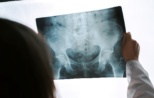 Qué debe incluir la historia clínica en traumatología