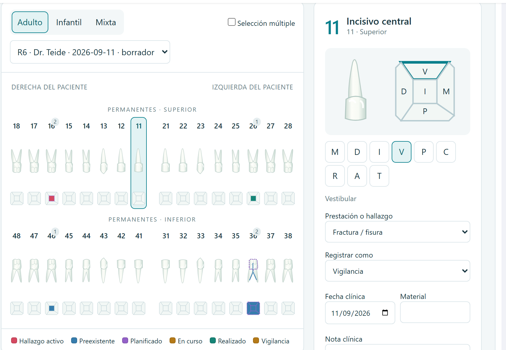 Odontograma clínico de Nubidoc: arcadas permanentes superior e inferior con hallazgos de colores, leyenda de estados y el panel de la pieza 11 con sus superficies
